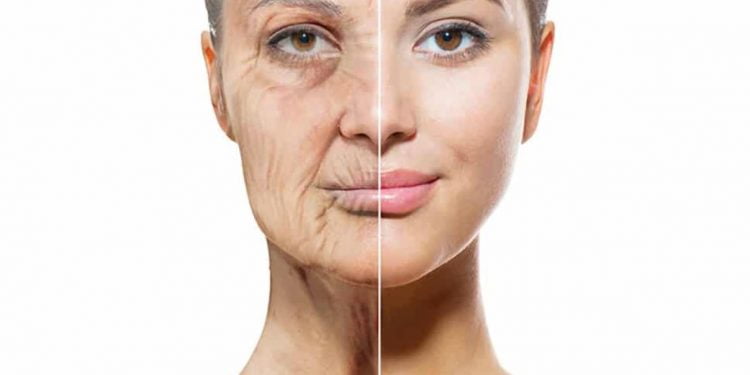 premature aging
