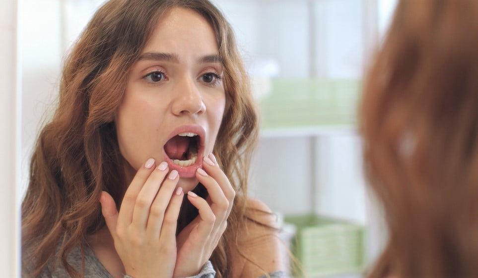 mouth sores diseases