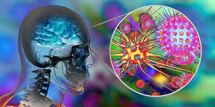 meningitis
